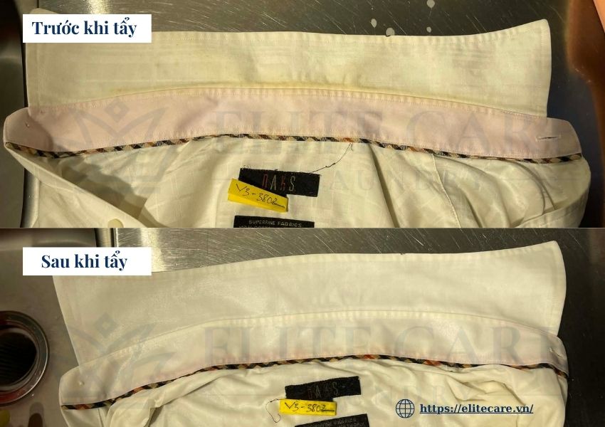 Ảnh trước và sau khi tẩy vết vàng cổ áo Elite Care Laundry