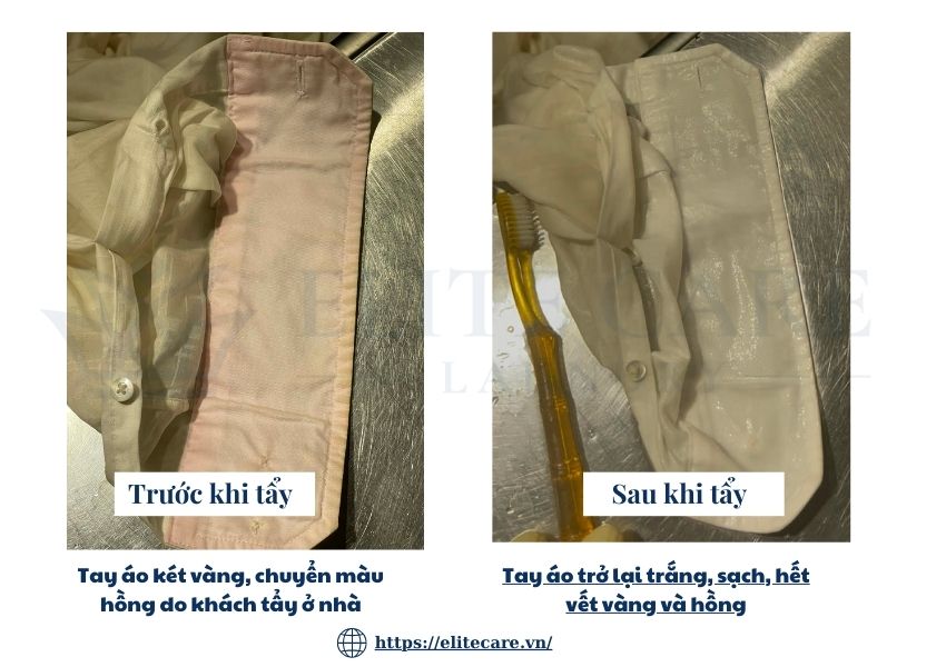 Ảnh trước và sau khi tẩy vết vàng tay áo Elite Care Laundry
